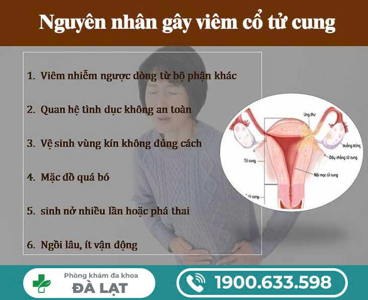 Hình ảnh minh họa